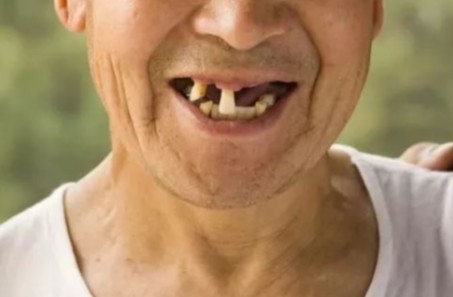 不止掉牙口臭！老年人口腔衰弱，是全身衰老的“预警灯”